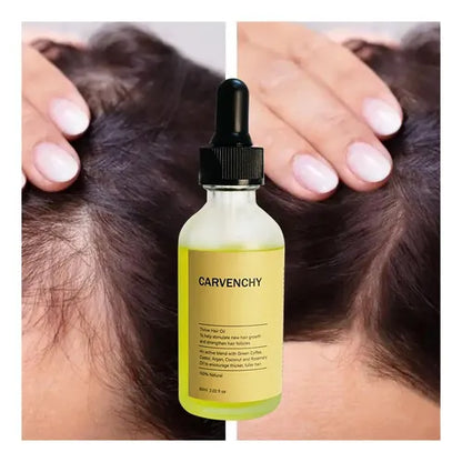 Carvenchi Serum — Crecimiento y Salud Capilar Premium